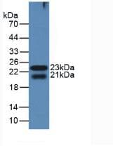 LGALS8 / Galectin 8 Antibody (aa151-316)