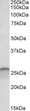 PathPlus™ Polyclonal Goat anti-Human CALB1 / Calbindin Antibody (aa59-72, IHC, WB)