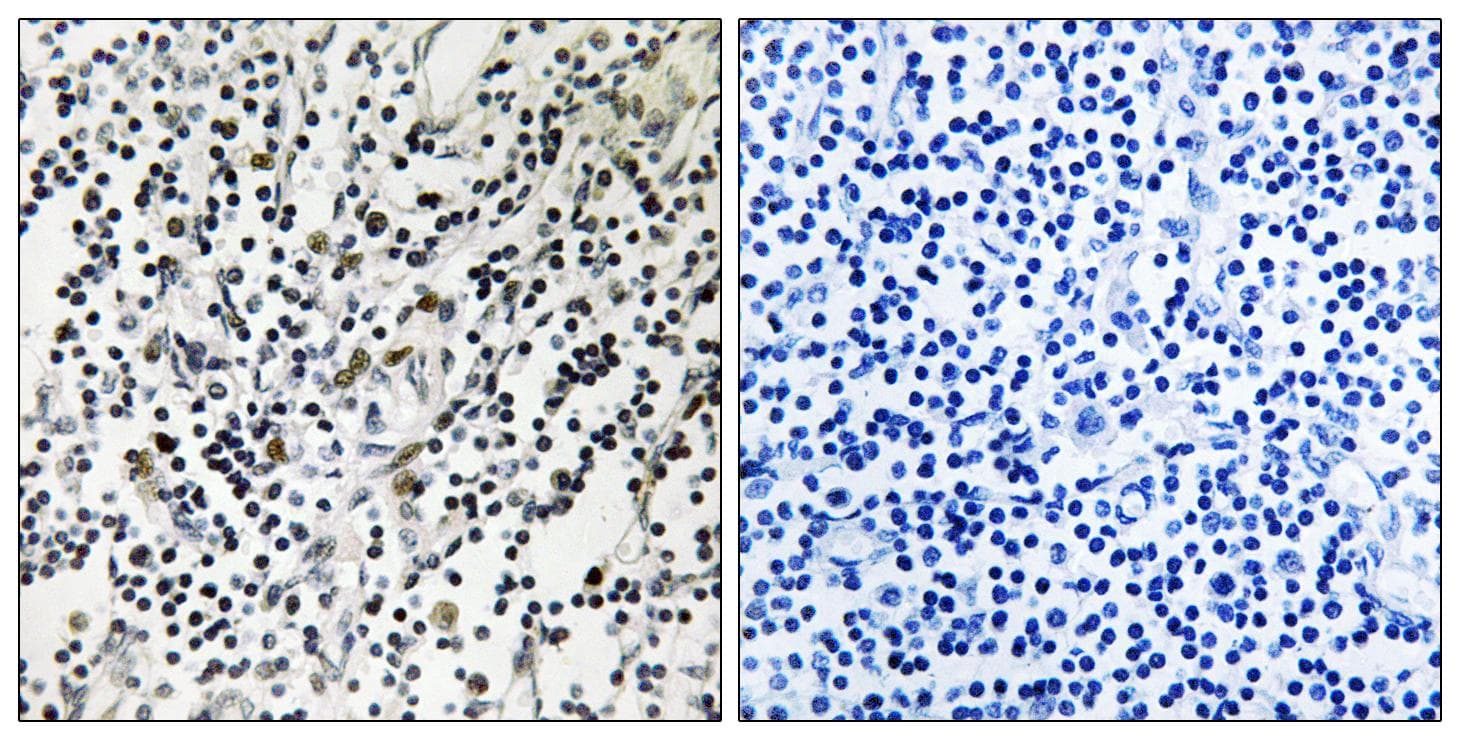 POU2F1 / OCT1 Antibody (phospho-Ser385)