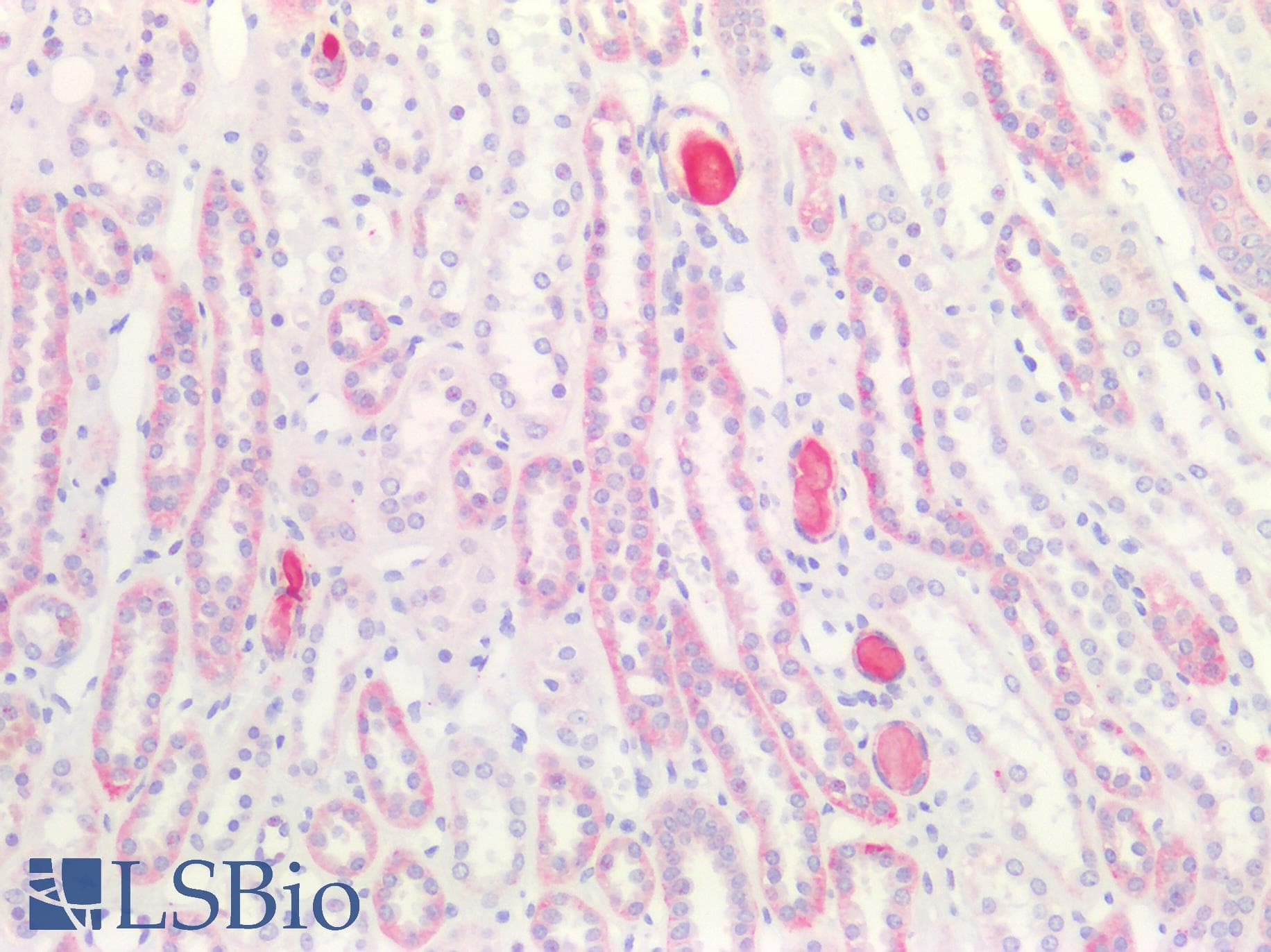 PathPlus™ CLDN4 / Claudin 4 Antibody (aa160-209)