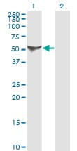 PathPlus™ ALDH1A1 / ALDH1 Antibody (clone 1G6)