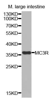 Polyclonal Rabbit anti-Human MC3R / MC3 Receptor Antibody (WB)