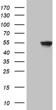 PAX3 Antibody (clone OTI4D1)