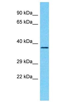 PHYHD1 Antibody (aa240-289)