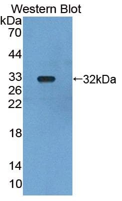PIDD1 Antibody (aa666-915, APC)