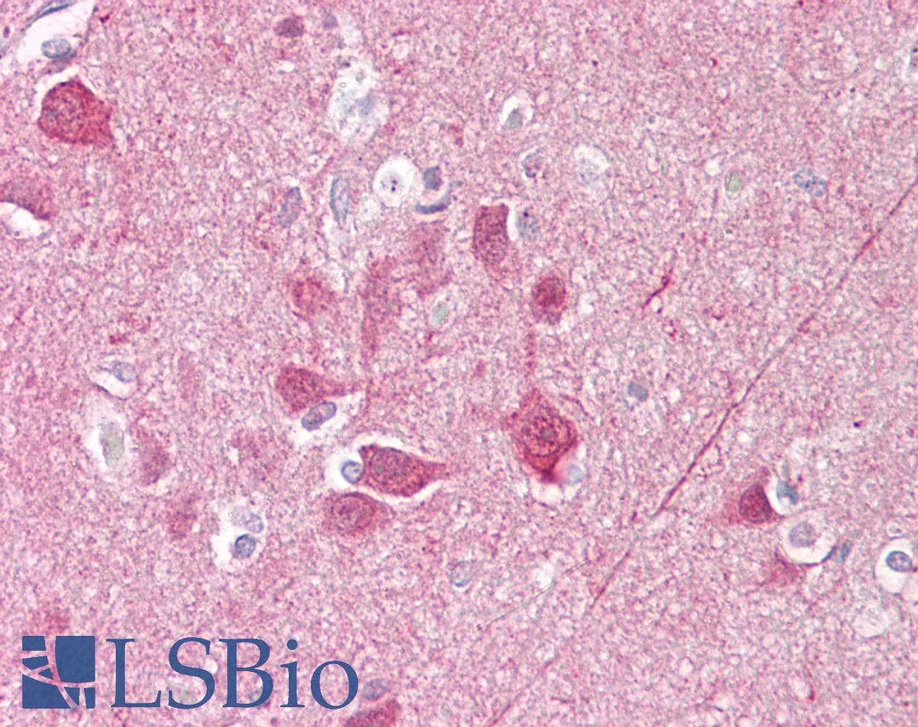 IHC-plus™ UCHL1 / PGP9.5 Antibody (aa50-100)