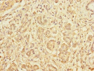 Polyclonal Rabbit anti-Human DIAPH2 Antibody (IHC, WB)