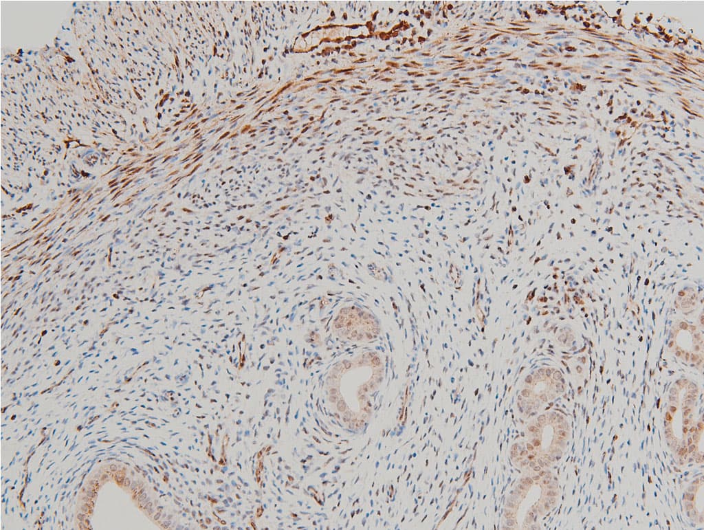 CFL1 / Cofilin Antibody (phospho-Ser3)
