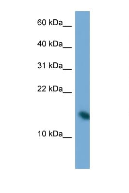 Polyclonal Rabbit anti-Human PAIP2 Antibody (N-Terminus, WB)