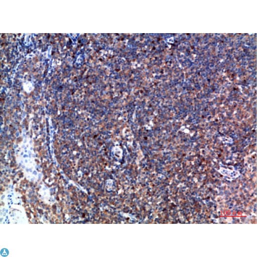 TPSD1 / Tryptase Delta 1 Antibody
