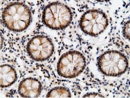 EPM2AIP1 Antibody (clone OTI2G3)