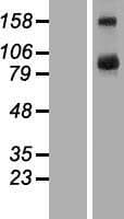 TBC1D16 Protein (Over-Expression Lysate Myc-DDK (Flag))