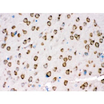 TRPM5 Antibody (aa1021-1108)
