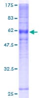 Human ACKR1 / DARC Protein (Recombinant GST)