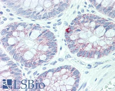 IHC-plus™ ABCB6 Antibody