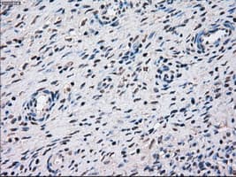 Monoclonal Mouse anti-Human STK3 Antibody (clone OTI2D4, IHC, WB)