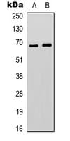 EPN3 Antibody (Internal)
