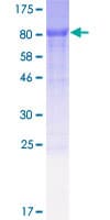 Human MUM1L1 Protein (Recombinant GST)