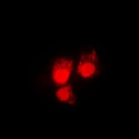 Polyclonal Rabbit anti-Human CDK1 / CDC2 Antibody (phospho-Thr161, IHC, IF, WB)