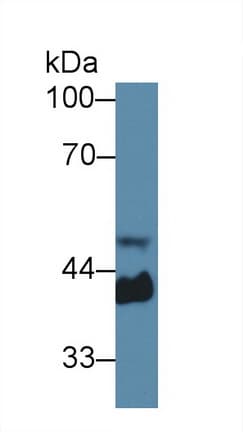 HP / Haptoglobin Antibody (aa70-332, APC)
