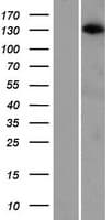 ARHGAP20 Protein (Over-Expression Lysate Myc-DDK (Flag))