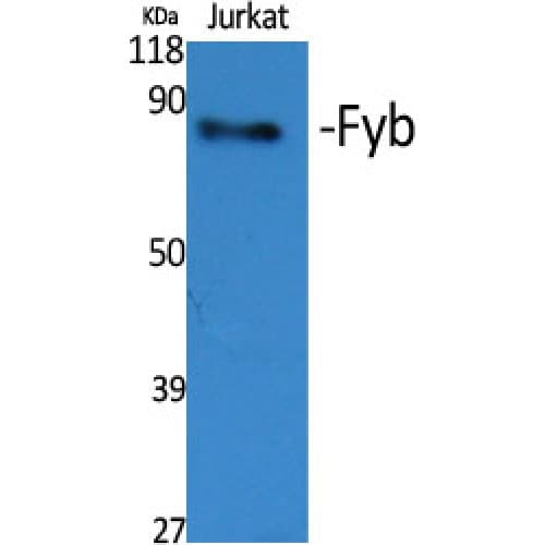 ADAP / FYB Antibody (620-700 aa, C-terminal)