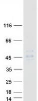 Human MR1 Protein (Recombinant Myc-DDK (Flag))