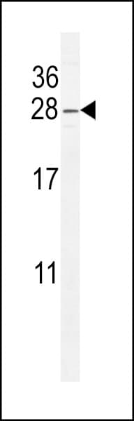Polyclonal Rabbit anti-Human ARL8 / ARL5B Antibody (aa122-154, IHC, WB)