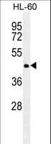 NR6A1 / GCNF Antibody (aa30-59)