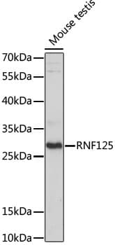 RNF125 / TRAC-1 Antibody