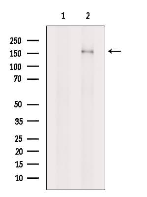 Polyclonal Rabbit anti-Human NPHP4 Antibody (WB)