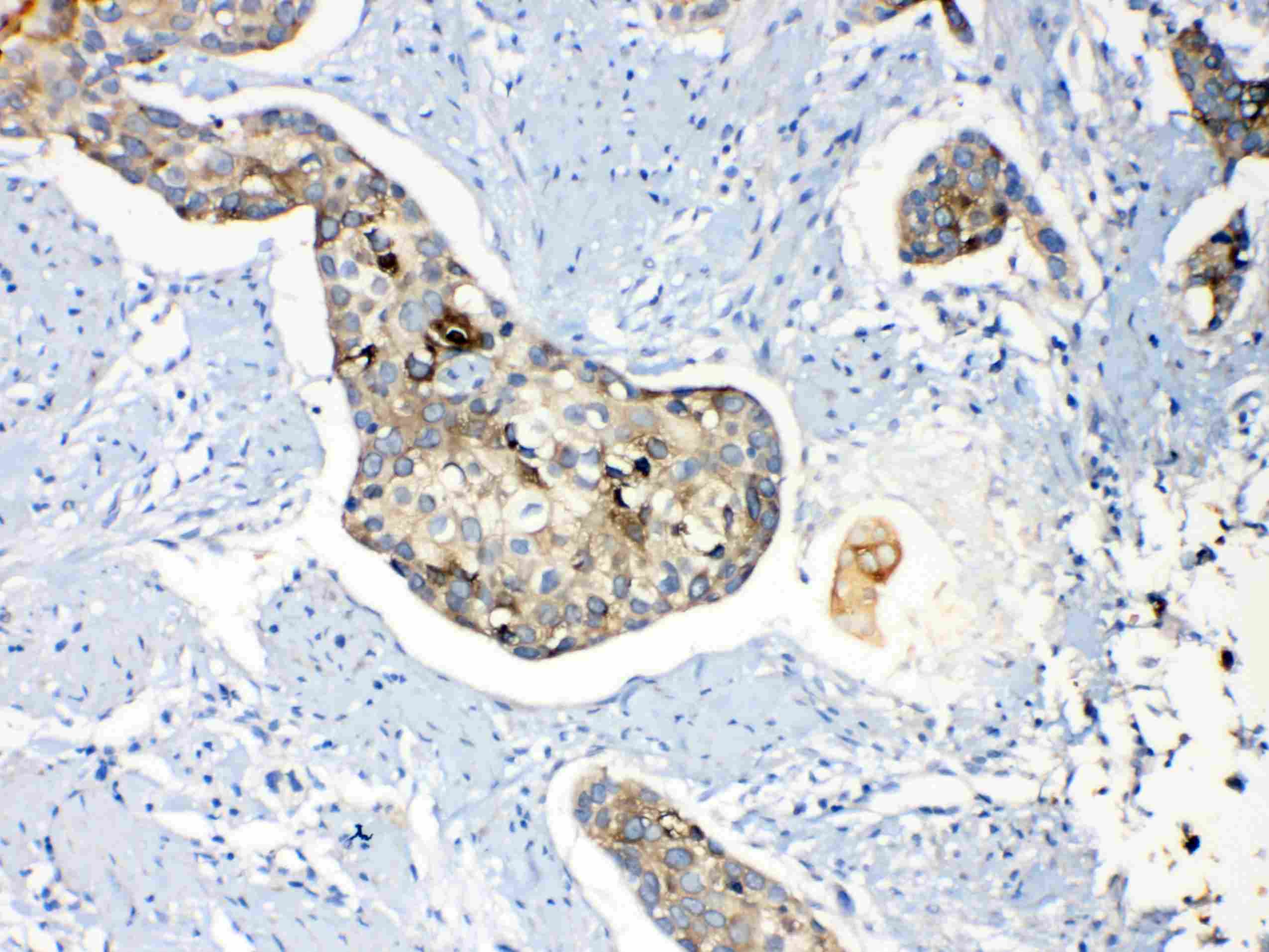 PPL / Periplakin Antibody