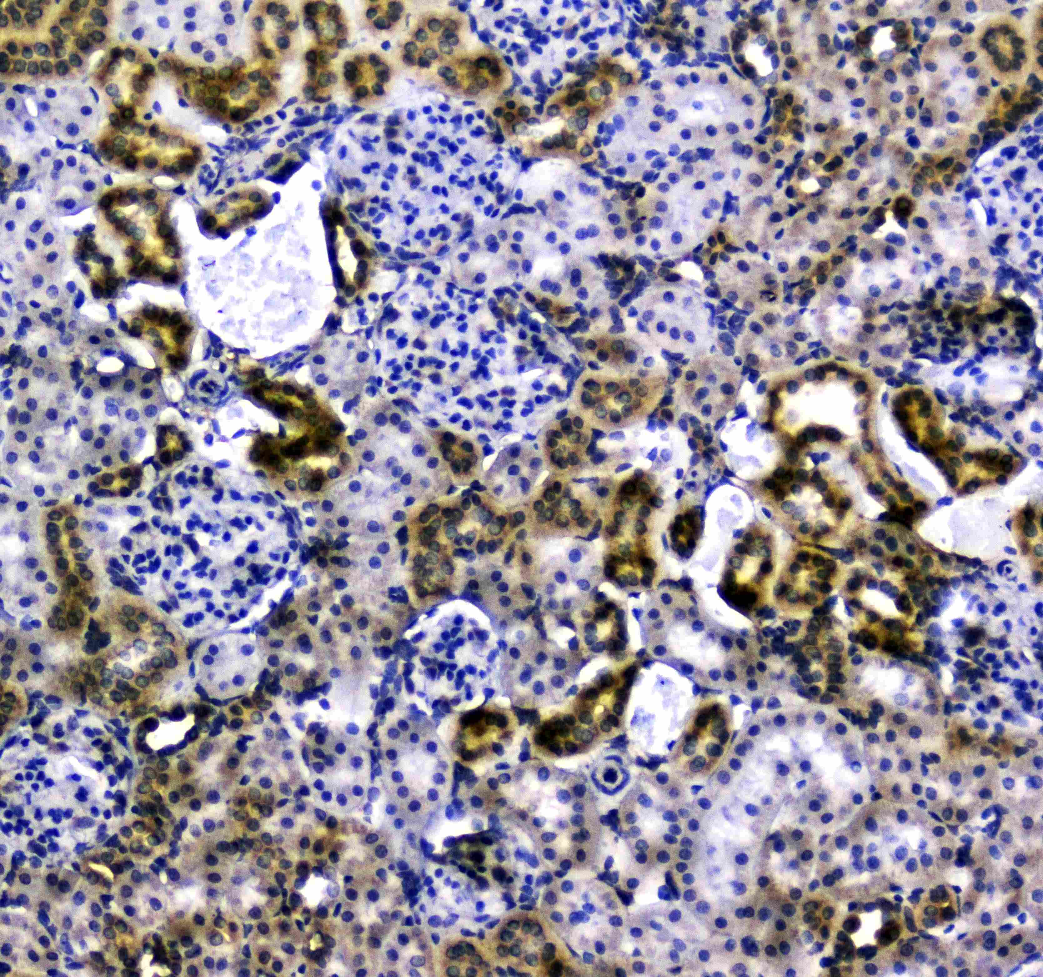 VCAM1 / CD106 Antibody