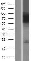 FACL2 / ACSL1 Protein (Over-Expression Lysate Myc-DDK (Flag))