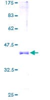Human HBA2 / Hemoglobin Alpha 2 Protein (Recombinant GST)