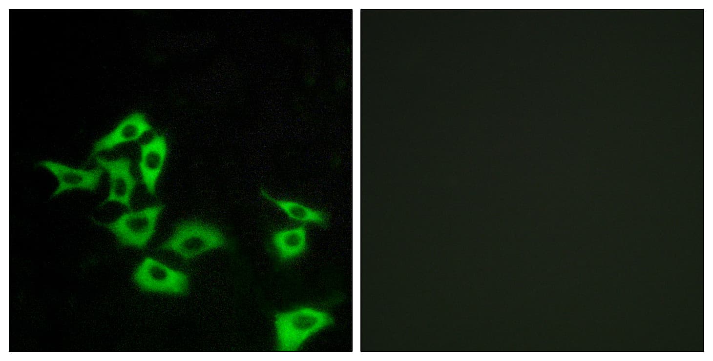 Polyclonal Rabbit anti-Human Frizzled 5+8 Antibody (aa31-80, IF, WB)
