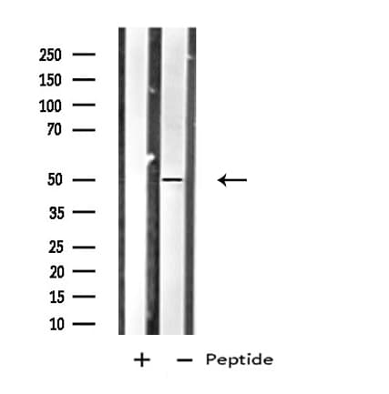 Polyclonal Rabbit anti-Human HTR1B / 5-HT1B Receptor Antibody (IF, WB)