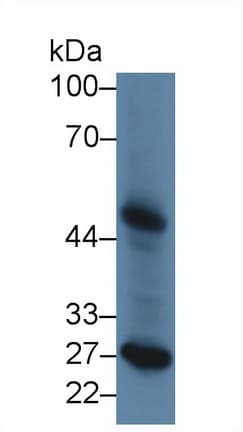 LP-PLA2 / PLA2G7 Antibody (aa22-444)