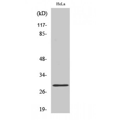 RAB20 Antibody (90-170 aa, Internal)