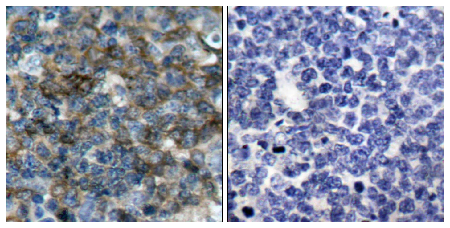 VASP Antibody (phospho-Ser157)