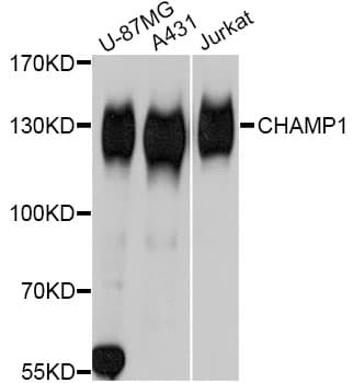 C13orf8 / ZNF828 Antibody