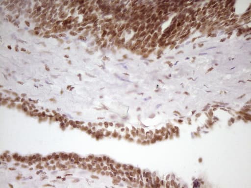 Monoclonal Mouse anti-Human SP110 Antibody (clone OTI4C1, aa232-521, IHC, WB)