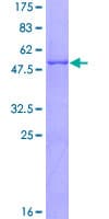 Human CTRB1 / Chymotrypsinogen B1 Protein (Recombinant GST)