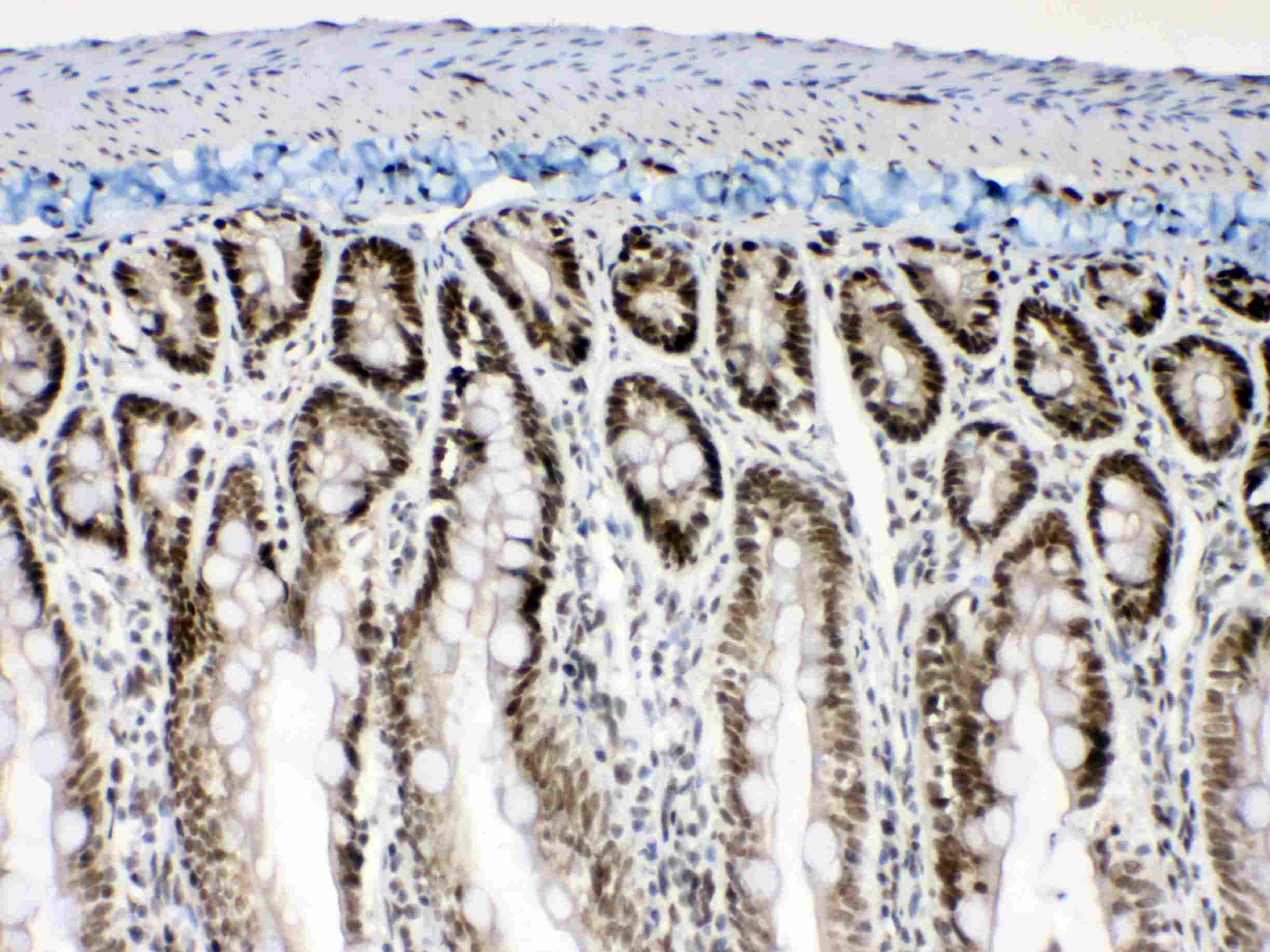 Polyclonal Rabbit anti-Human MSI1 / Musashi 1 Antibody (IHC, WB)