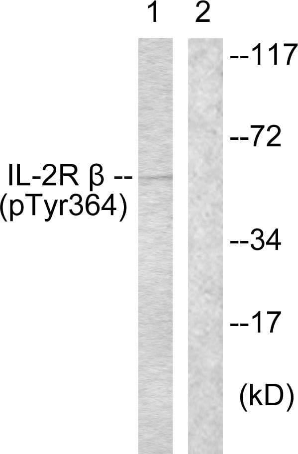 IL2RB / CD122 Antibody (phospho-Tyr364)