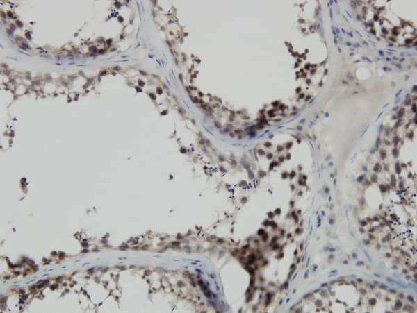 PBK / TOPK Antibody (clone 3A11)