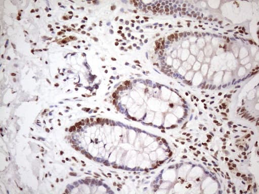 EXOSC1 / CSL4 Antibody (clone OTI4B7)