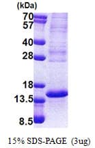 Human TP53AIP1 / p53 AIP1 Protein (Recombinant His)