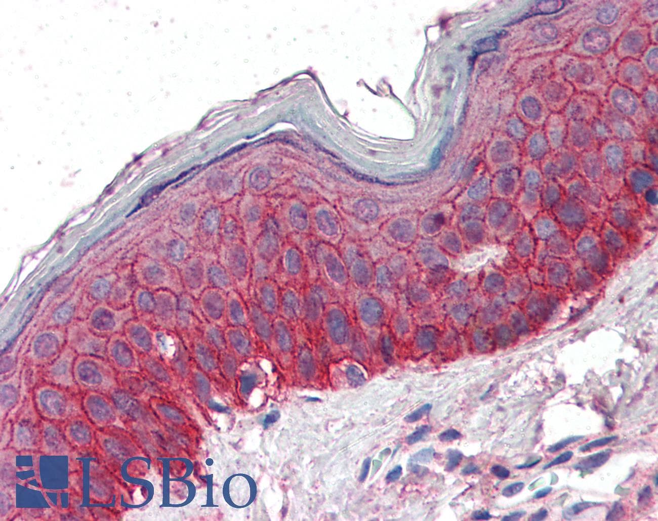 IHC-plus™ Polyclonal Sheep anti-Human EGFR Antibody (Internal, IHC, WB)