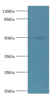ALDH3A1 Antibody